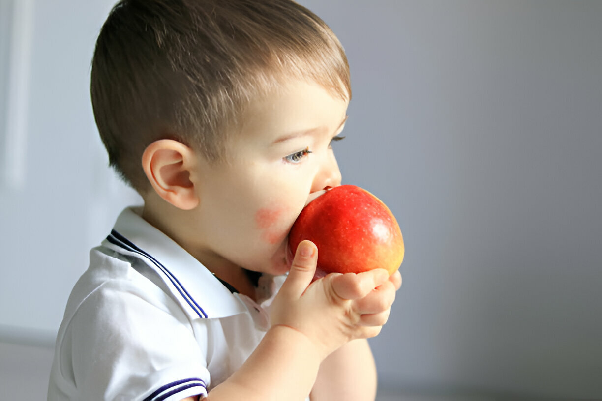 Alergias alimentarias en bebés